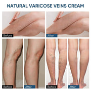 Leg Massage Relieve Leg Earthworm Leg Swelling Vein Repairing Cream