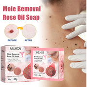 Cure Warts Remove Moles Face And Neck Filamentous Warts Body Cleaning Soap