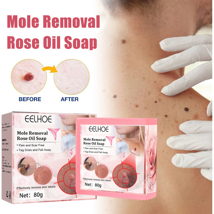 Cure Warts Remove Moles Face And Neck Filamentous Warts Body Cleaning Soap