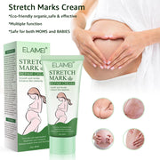 Stretch Mark Repair Cream Smooth Tender Enhance Skin Elastictiy Acne Repair 60ml Anti-Aging Cream Pregnancy Scars