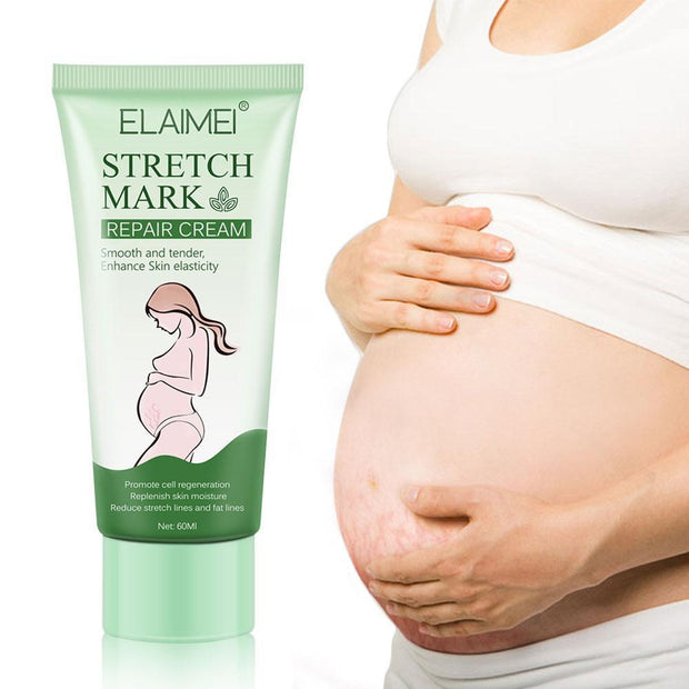 Stretch Mark Repair Cream Smooth Tender Enhance Skin Elastictiy Acne Repair 60ml Anti-Aging Cream Pregnancy Scars