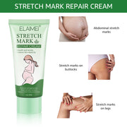 Stretch Mark Repair Cream Smooth Tender Enhance Skin Elastictiy Acne Repair 60ml Anti-Aging Cream Pregnancy Scars